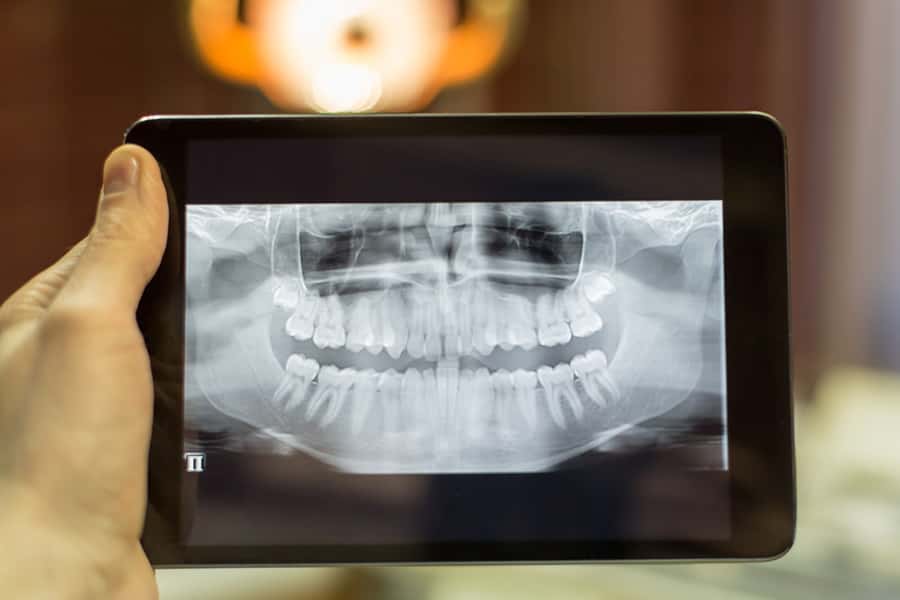 Digital Radiography in Pflugerville, TX