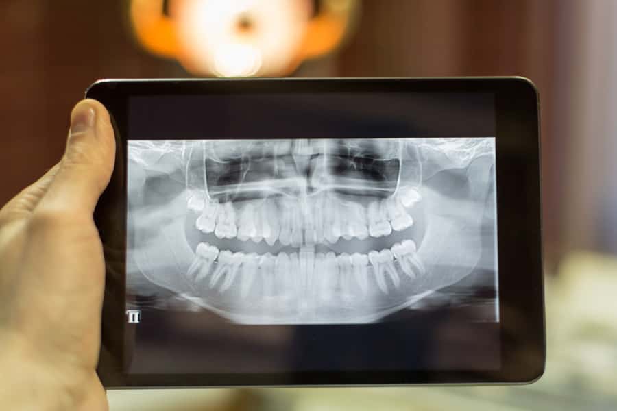 Our latest dental technology near 78660 helps Dr. Michele de Souza, well-qualified general dentist in 78660, determine which dental treatment is right for you! Digital Radiography in Pflugerville, TX
